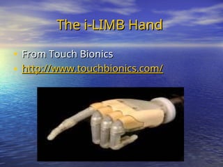 The i-LIMB Hand
The i-LIMB Hand
• From Touch Bionics
From Touch Bionics
• http://www.touchbionics.com/
http://www.touchbionics.com/
 