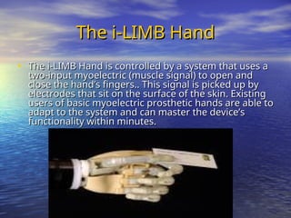 The i-LIMB Hand
The i-LIMB Hand
• The i-LIMB Hand is controlled by a system that uses a
The i-LIMB Hand is controlled by a system that uses a
two-input myoelectric (muscle signal) to open and
two-input myoelectric (muscle signal) to open and
close the hand’s fingers.. This signal is picked up by
close the hand’s fingers.. This signal is picked up by
electrodes that sit on the surface of the skin. Existing
electrodes that sit on the surface of the skin. Existing
users of basic myoelectric prosthetic hands are able to
users of basic myoelectric prosthetic hands are able to
adapt to the system and can master the device’s
adapt to the system and can master the device’s
functionality within minutes.
functionality within minutes.
 