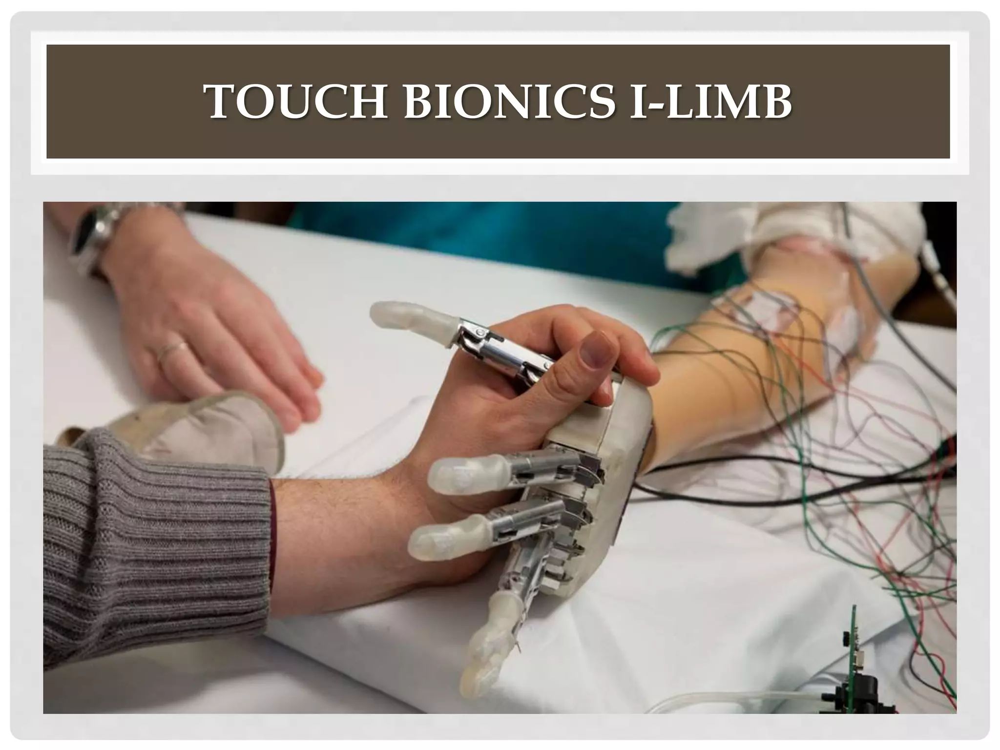 TOUCH BIONICS I-LIMB 
 
