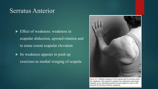 Serratus Anterior
 Effect of weakness: weakness in
scapular abduction, upward rotation and
to some extent scapular elevation
 Its weakness appears in push up
exercises as medial winging of scapula
 