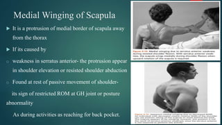 Medial Winging of Scapula
 It is a protrusion of medial border of scapula away
from the thorax
 If its caused by
o weakness in serratus anterior- the protrusion appear
in shoulder elevation or resisted shoulder abduction
o Found at rest of passive movement of shoulder-
its sign of restricted ROM at GH joint or posture
abnormality
As during activities as reaching for back pocket.
 