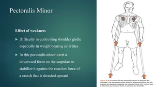 Pectoralis Minor
Effect of weakness
 Difficulty in controlling shoulder girdle
especially in weight bearing activities
 In this pectoralis minor exert a
downward force on the scapulae to
stabilize it against the reaction force of
a crutch that is directed upward
 