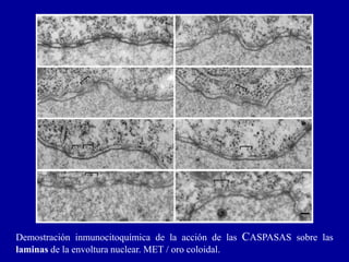 Demostración inmunocitoquímica de la acción de las CASPASAS sobre las
laminas de la envoltura nuclear. MET / oro coloidal.
 