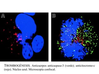 TROMBOGÉNESIS. Anticuerpos anticaspasa-3 (verde); anticitocromo-c
(rojo). Núcleo azul. Microscopía confocal.
 