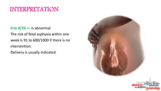 0 to 4/10 — is abnormal.
The risk of fetal asphyxia within one
week is 91 to 600/1000 if there is no
intervention.
Delivery is usually indicated.
INTERPRETATION
 