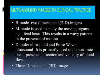 ULTRASOUNDIMAGESINCLINCALPRACTICE
 B-mode–two dimensional (2-D) images
 M-mode is used to study the moving organs
e.g., fetal heart. This results in a wavy pattern
in the presence of motion
 Doppler ultrasound and Pulse Wave
ultrasound- It is primarily used to demonstrate
the presence, direction and velocity of blood
flow.
 Three Dimensional (3D) images.
 