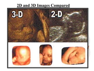 2D and 3D Images Compared
 