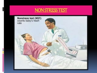 NONSTRESSTEST
 