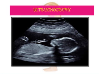 ULTRASONOGRAPHY
 