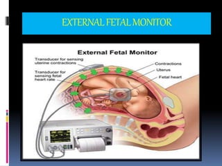 EXTERNALFETALMONITOR
 