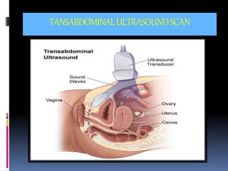 TANSABDOMINALULTRASOUNDSCAN
 
