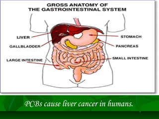 PCBs cause liver cancer in humans. 
 
