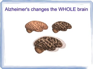 Alzheimer's changes the WHOLE brain 