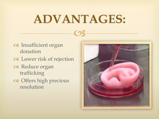 
ADVANTAGES:
 Insufficient organ
donation
 Lower risk of rejection
 Reduce organ
trafficking
 Offers high precious
resolution
 