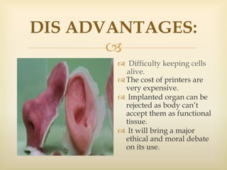 
DIS ADVANTAGES:
 Difficulty keeping cells
alive.
The cost of printers are
very expensive.
 Implanted organ can be
rejected as body can’t
accept them as functional
tissue.
 It will bring a major
ethical and moral debate
on its use.
 