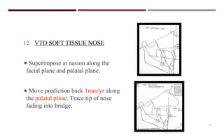 35
12. VTO SOFT TISSUE NOSE
 Superimpose at nasion along the
facial plane and palatal plane.
 Move prediction back 1mm/yr along
the palatal plane. Trace tip of nose
fading into bridge.
 