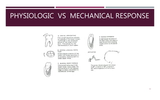 PHYSIOLOGIC VS MECHANICAL RESPONSE
77
 