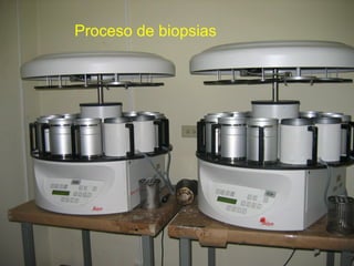 Proceso de biopsias
 