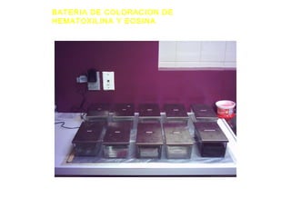 BATERIA DE COLORACION DE
HEMATOXILINA Y EOSINA
 