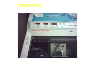 CRIOSTATO
 