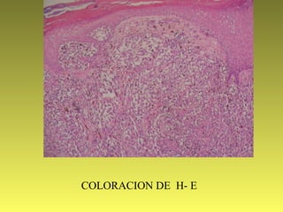 COLORACION DE H- E
 