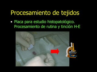 Procesamiento de tejidos Placa para estudio histopatológico. Procesamiento de rutina y tinción H-E 