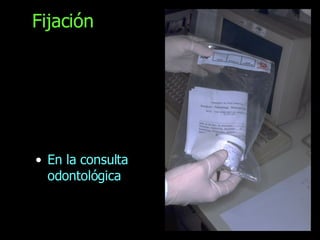 Fijación En la consulta odontológica 