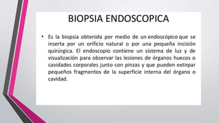 Biopsia