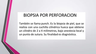 Biopsia