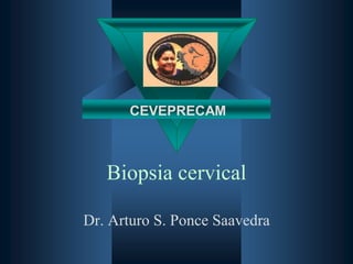 CEVEPRECAM

Biopsia cervical
Dr. Arturo S. Ponce Saavedra

 