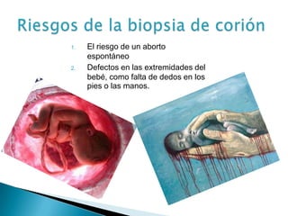 1.   El riesgo de un aborto
     espontáneo
2.   Defectos en las extremidades del
     bebé, como falta de dedos en los
     pies o las manos.
 