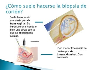 Suele hacerse sin
anestesia por vía
transvaginal. Se
introduce una sonda o
bien una pinza con la
que se obtienen las
células.



                         Con menor frecuencia se
                        realiza por vía
                        transabdominal. Con
                        anestesia
 