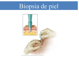 Biopsia de piel
 