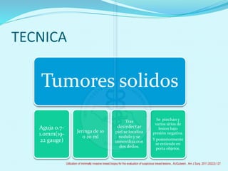 TECNICA
Tumores solidos
Aguja 0.7-
1.0mm(19-
22 gauge)
Jeringa de 10
o 20 ml
Tras
desinfectar
piel se localiza
nodulo y se
inmoviliza con
dos dedos.
Se pinchan y
varios sitios de
lesion bajo
presión negativa.
Y posteriormente
se extiende en
porta objetos.
Utilization of minimally invasive breast biopsy for the evaluation of suspicious breast lesions., AUGutwein , Am J Surg. 2011;202(2):127.
 