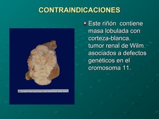 CONTRAINDICACIONES
Este riñón contiene
masa lobulada con
corteza-blanca.
tumor renal de Wilm
asociados a defectos
genéticos en el
cromosoma 11.

 