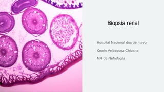Biopsia renal
 