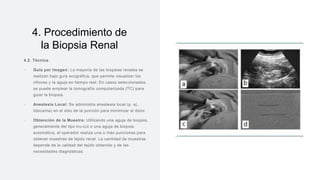 Biopsia Riñon Biopsia renal es un procedimiento diagnostico | PPTX