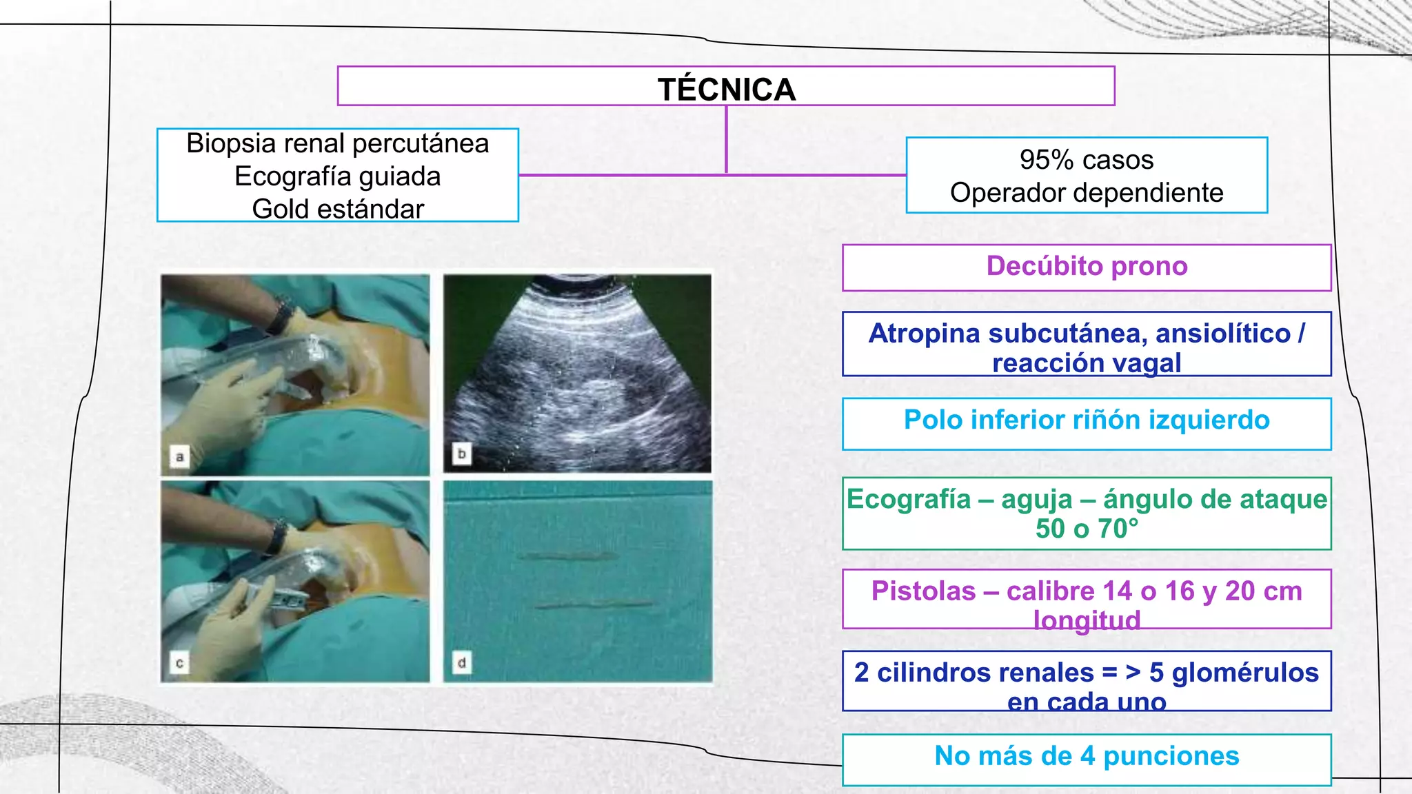 Biopsia Riñon biopsia renal final.pptx
