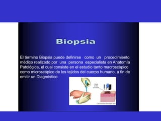 BIOPSIA
El tèrmino Biopsia puede definirse como un procedimiento
médico realizado por una persona especialista en Anatomía
Patológica, el cual consiste en el estudio tanto macroscòpico
como microscópico de los tejidos del cuerpo humano, a fin de
emitir un Diagnóstico
 