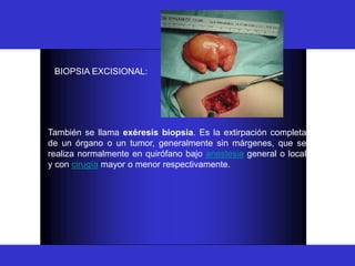 BIOPSIA
BIOPSIA EXCISIONAL:
También se llama exéresis biopsia. Es la extirpación completa
de un órgano o un tumor, generalmente sin márgenes, que se
realiza normalmente en quirófano bajo anestesia general o local
y con cirugía mayor o menor respectivamente.
 