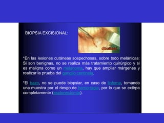 BIOPSIA
BIOPSIA EXCISIONAL:
*En las lesiones cutáneas sospechosas, sobre todo melánicas:
Si son benignas, no se realiza más tratamiento quirúrgico y si
es maligna como un melanoma, hay que ampliar márgenes y
realizar la prueba del ganglio centinela.
*El bazo, no se puede biopsiar, en caso de linfoma, tomando
una muestra por el riesgo de hemorragia, por lo que se extirpa
completamente (esplenectomía).
 