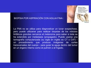 BIOPSIA
BIOPSIA POR ASPIRACIÒN CON AGUJA FINA :
La FNA no se utiliza para diagnosticar un lunar sospechoso,
pero puede utilizarse para realizar biopsias de los nódulos
linfáticos grandes cercanos al melanoma para saber si éste se
ha extendido por metástasis (propagado). Puede usarse una
tomografía computarizada (su sigla en inglés es CT o CAT) -
un procedimiento que produce imágenes de cortes
transversales del cuerpo - para guiar la aguja dentro del tumor
en un órgano interno como el pulmón o el hígado.
 