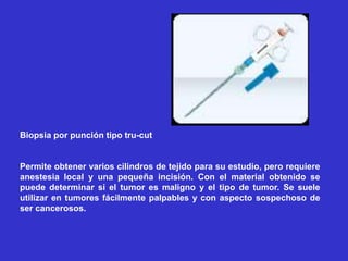 Biopsia por punción tipo tru-cut
Permite obtener varios cilindros de tejido para su estudio, pero requiere
anestesia local y una pequeña incisión. Con el material obtenido se
puede determinar si el tumor es maligno y el tipo de tumor. Se suele
utilizar en tumores fácilmente palpables y con aspecto sospechoso de
ser cancerosos.
 
