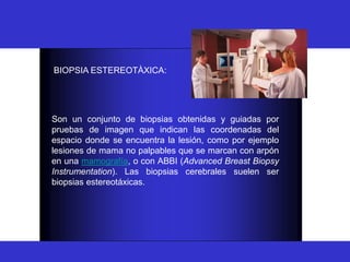 BIOPSIA
Son un conjunto de biopsias obtenidas y guiadas por
pruebas de imagen que indican las coordenadas del
espacio donde se encuentra la lesión, como por ejemplo
lesiones de mama no palpables que se marcan con arpón
en una mamografía, o con ABBI (Advanced Breast Biopsy
Instrumentation). Las biopsias cerebrales suelen ser
biopsias estereotáxicas.
BIOPSIA ESTEREOTÀXICA:
 