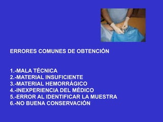 ERRORES COMUNES DE OBTENCIÓN
1.-MALA TÉCNICA
2.-MATERIAL INSUFICIENTE
3.-MATERIAL HEMORRÁGICO
4.-INEXPERIENCIA DEL MÉDICO
5.-ERROR AL IDENTIFICAR LA MUESTRA
6.-NO BUENA CONSERVACIÓN
 