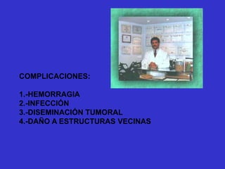 COMPLICACIONES:
1.-HEMORRAGIA
2.-INFECCIÓN
3.-DISEMINACIÓN TUMORAL
4.-DAÑO A ESTRUCTURAS VECINAS
 