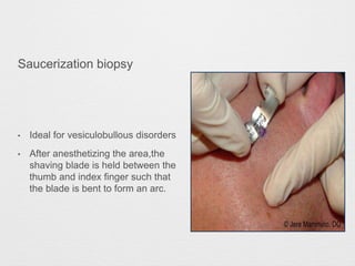 BIOPSY clinical procedure which aids in diagnosis and treatment ...