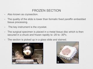Cryosection Sample BIOPSY clinical procedure which aids in diagnosis and treatment ...
