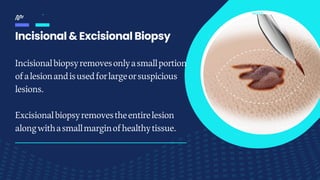 Biopsy Biopsy and Types of Biopsies - Faculty of Dentistry | PDF
