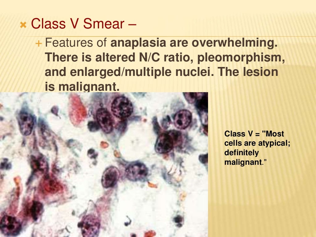 Biopsy and Exfoliative Cytology
